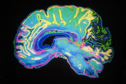 handheld mri scan scanner future medical technology timeline