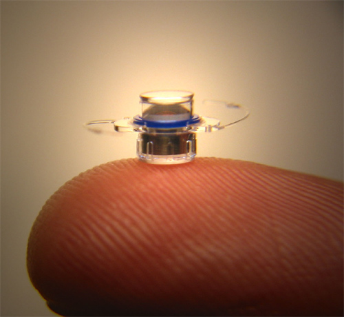 implantable miniature telescope visioncare macular degeneration  2010 future treatment cure