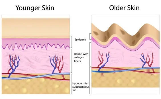 young and old skin diagram