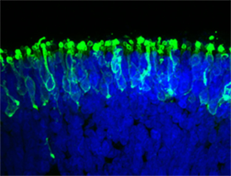 stem cells retina