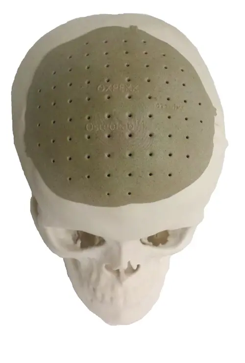 3d printed skull