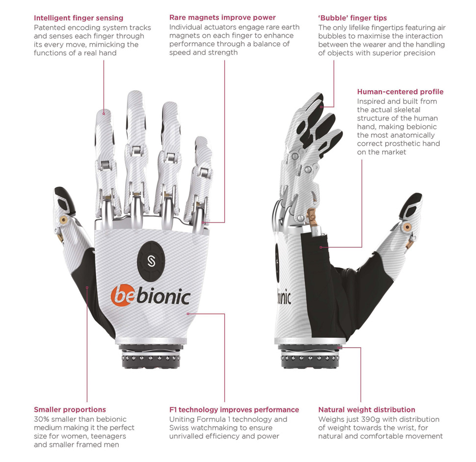 World's most lifelike bionic hand will transform the lives of amputees