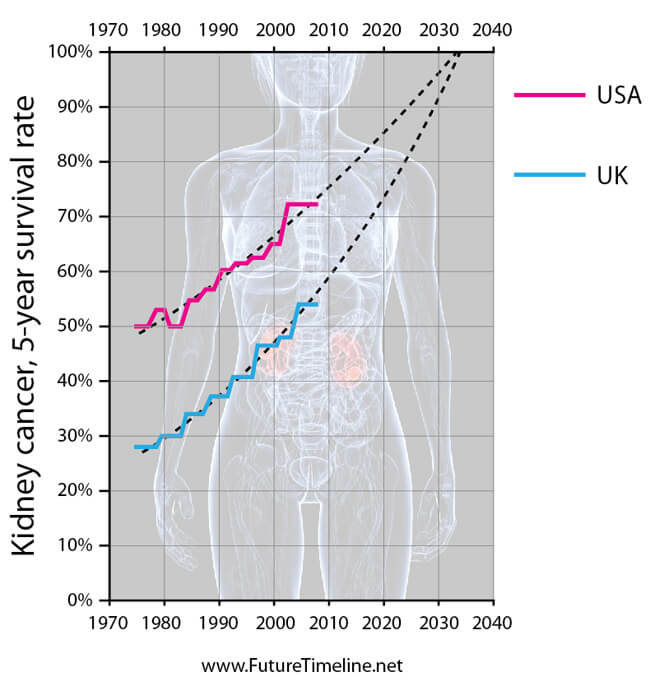 2033 prediction cancer