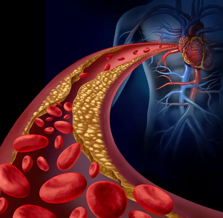 drug melts away fat inside arteries
