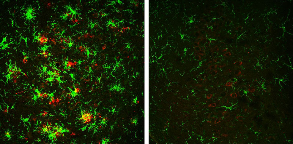 alzheimers mouse brain future timeline