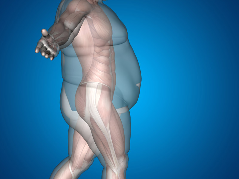obesity future trend 2045