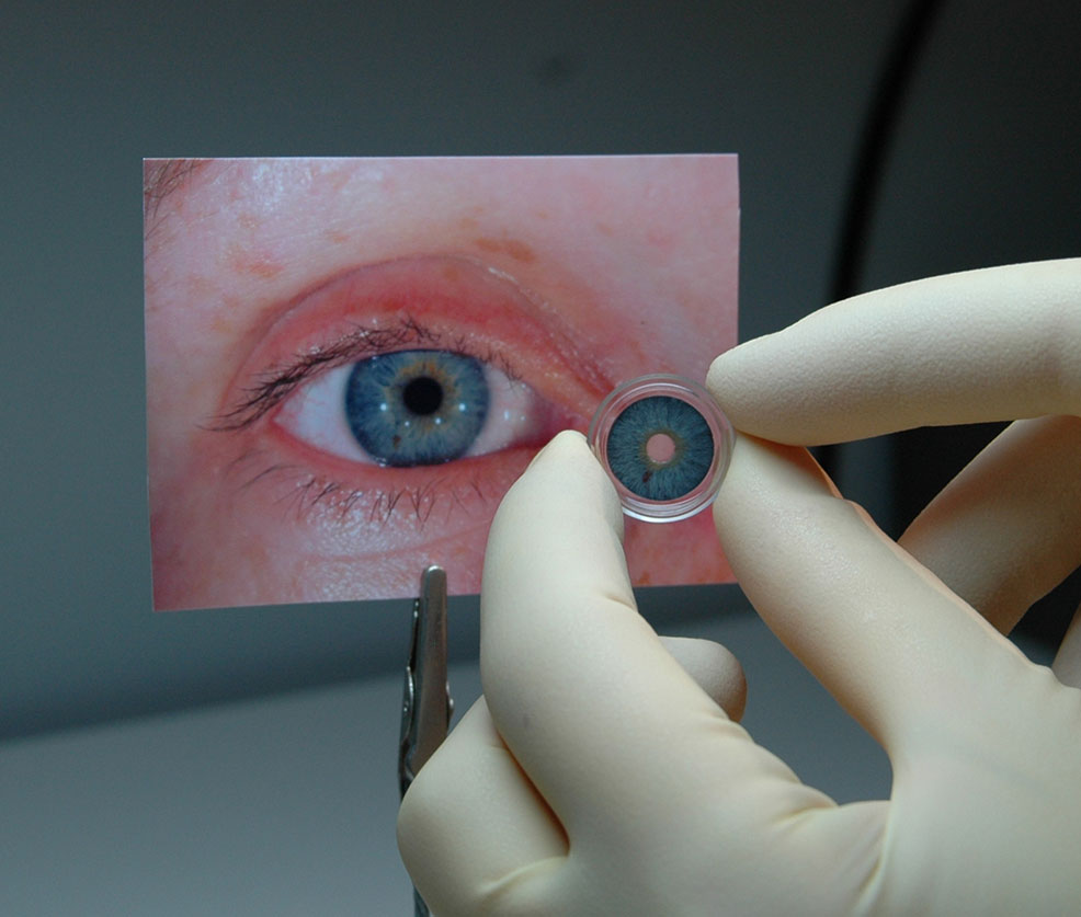 artificial iris fda future technology timeline