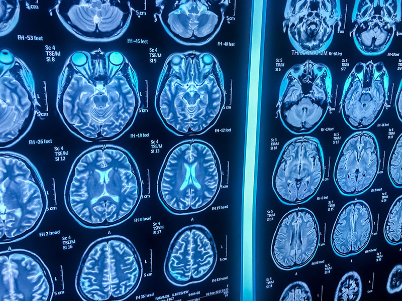 brain scan algorithm future technology timeline