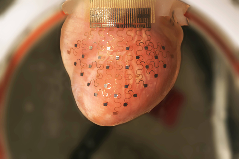 3d printed electronic membrane