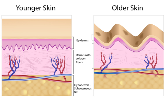 young and old skin diagram