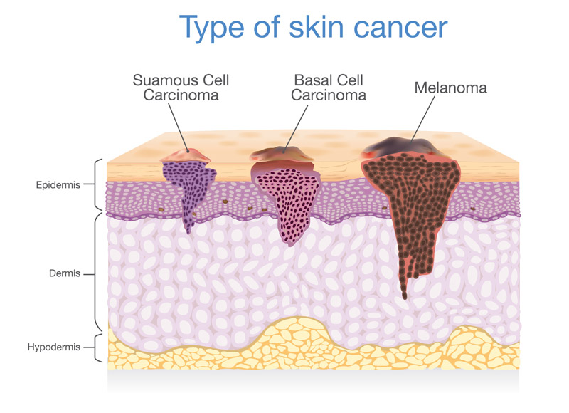 cancer future timeline