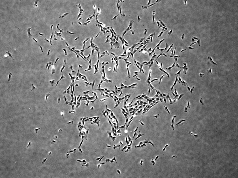 skeletal stem cells future timeline