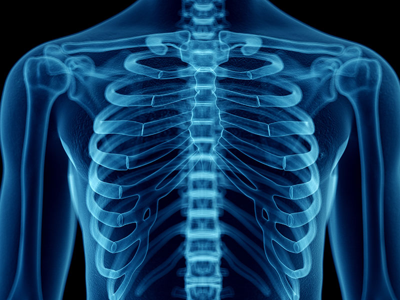 chest xray ai technology