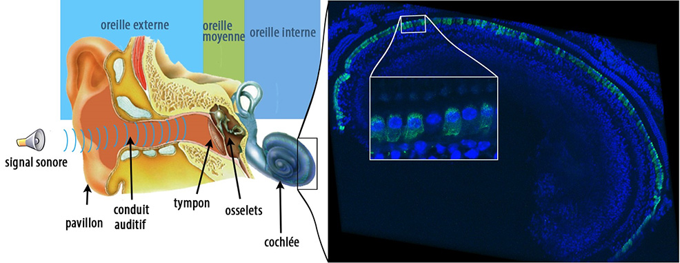 deafness cure gene therapy