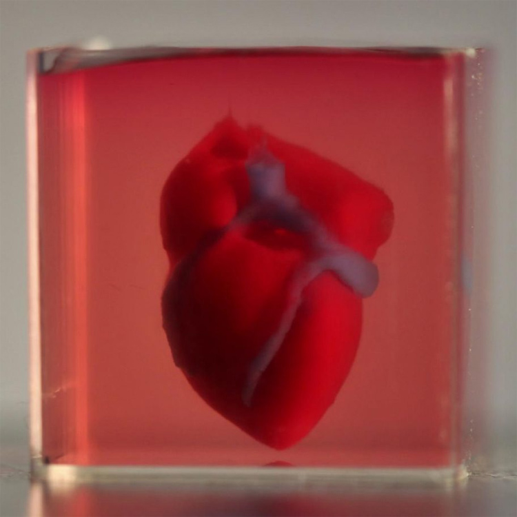 first 3d printed heart using patients own cells