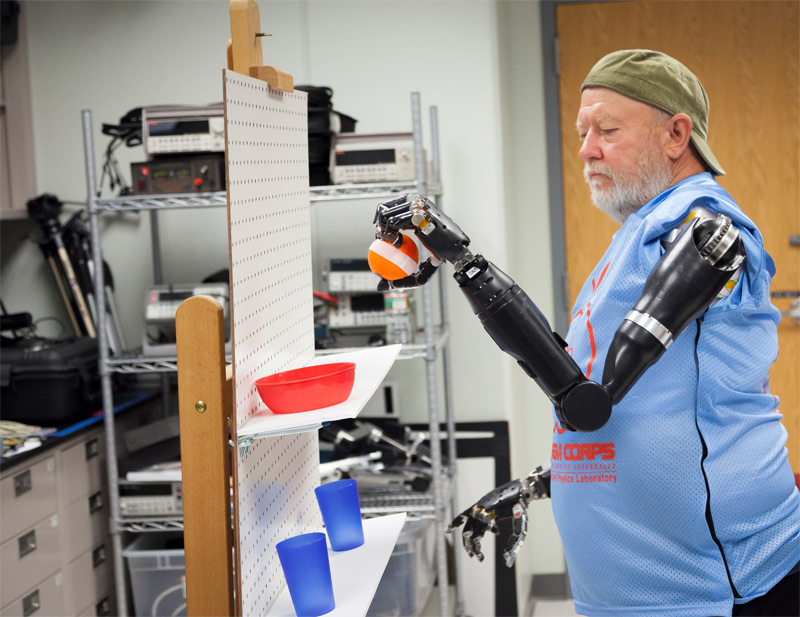 first man with two mind controlled prosthetic limbs