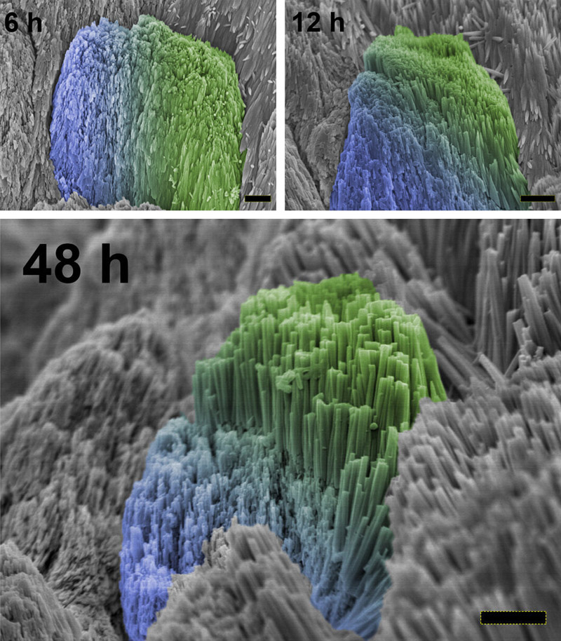 enamel regrowing technology