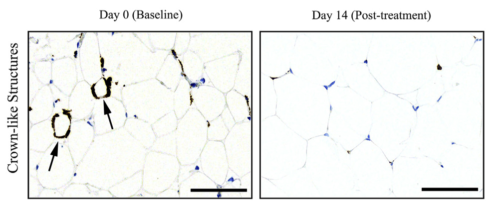 senescent cells aging humans