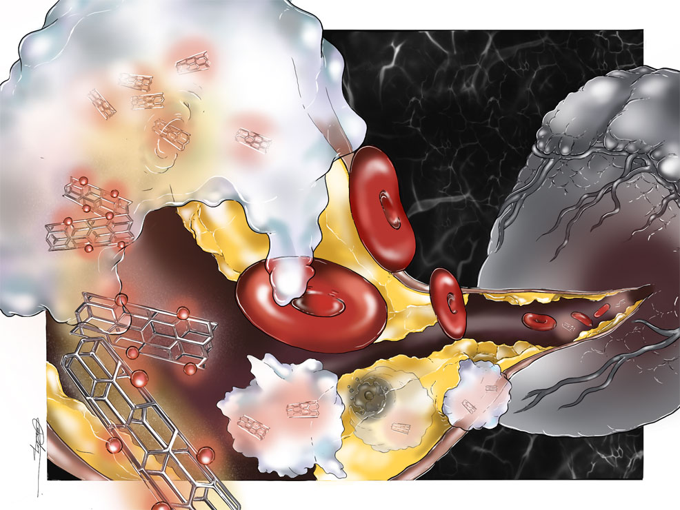 nanoparticles eating plaque