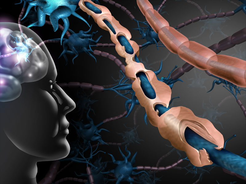 mrna vaccine multiple sclerosis