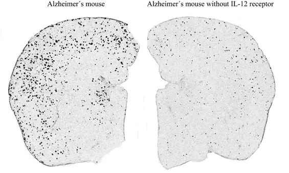 mouse alzheimers