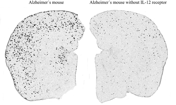 mouse alzheimers