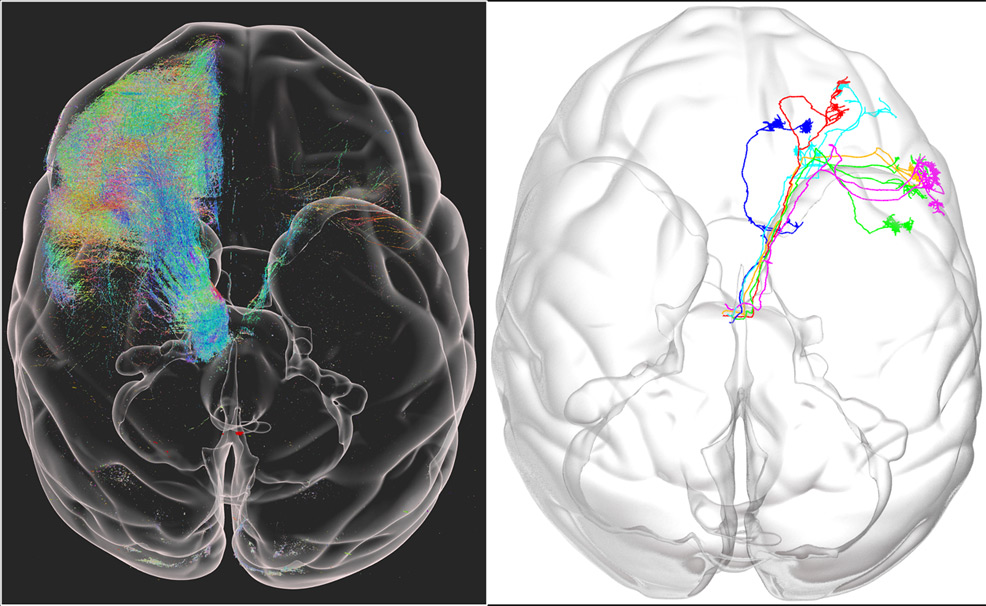 monkey brain 3d map future timeline