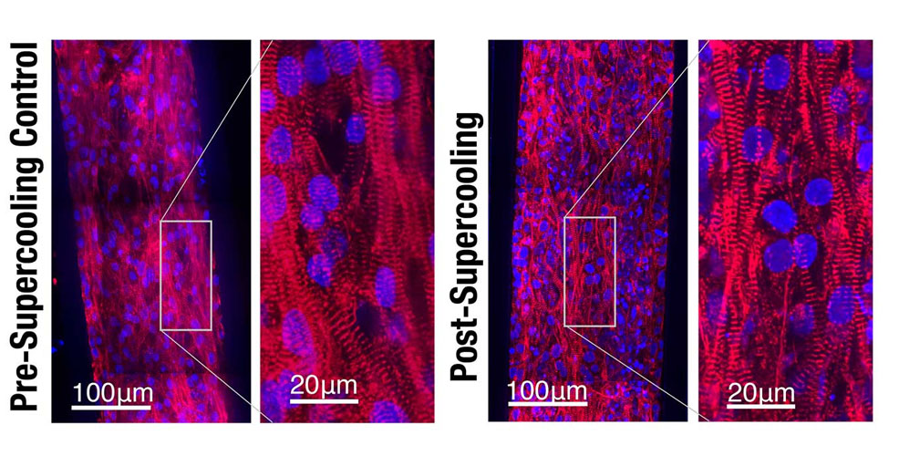 cryopreservation heart tissue technology