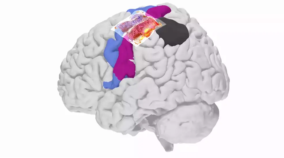 human brain signals record breaking resolution