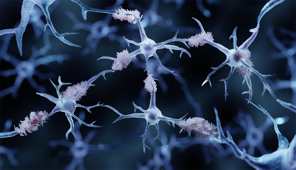 alzheimers disease future treatment