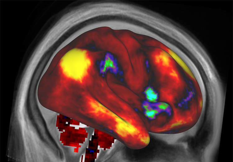 brain scan