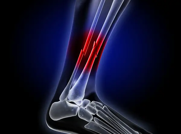 faster healing of bone injuries stem cells