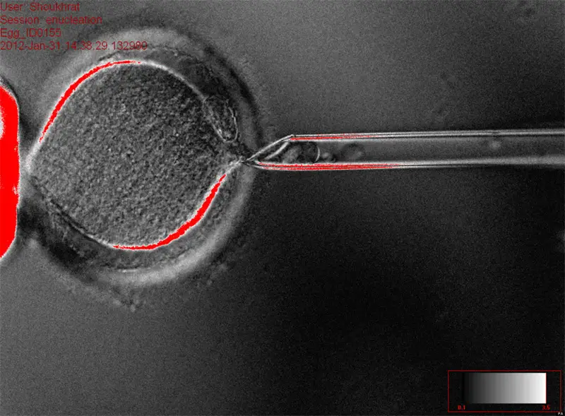 human embryonic stem cells cloning