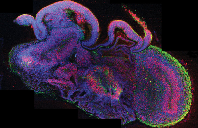 lab grown brain