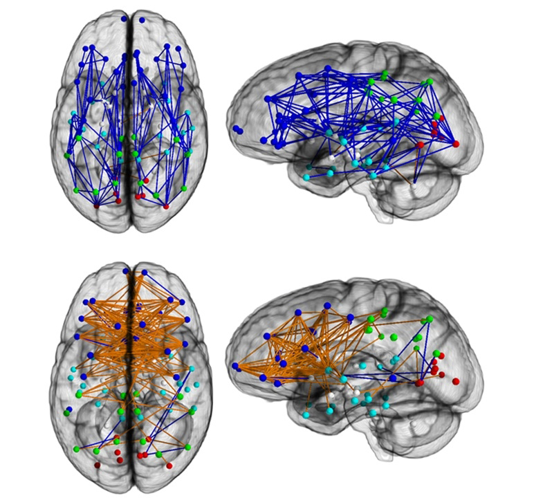 brain scans