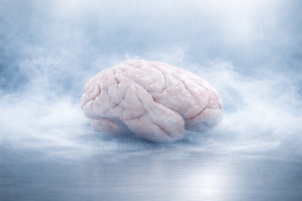 brain cryopreservation pig brain study