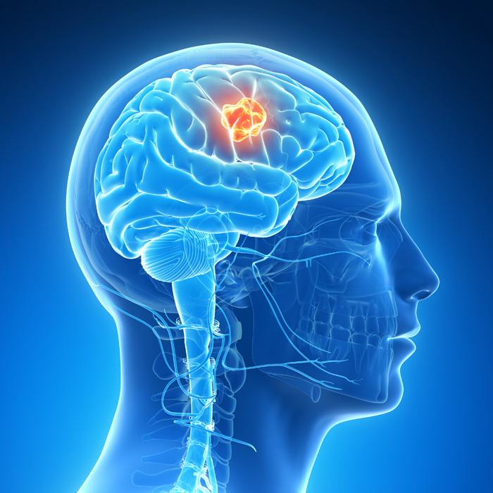 brain tumour future timeline