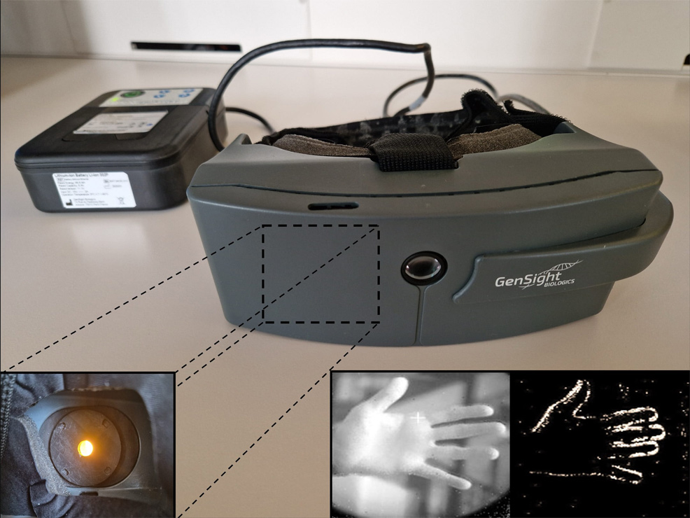 gene therapy partially restores sight in blind patients