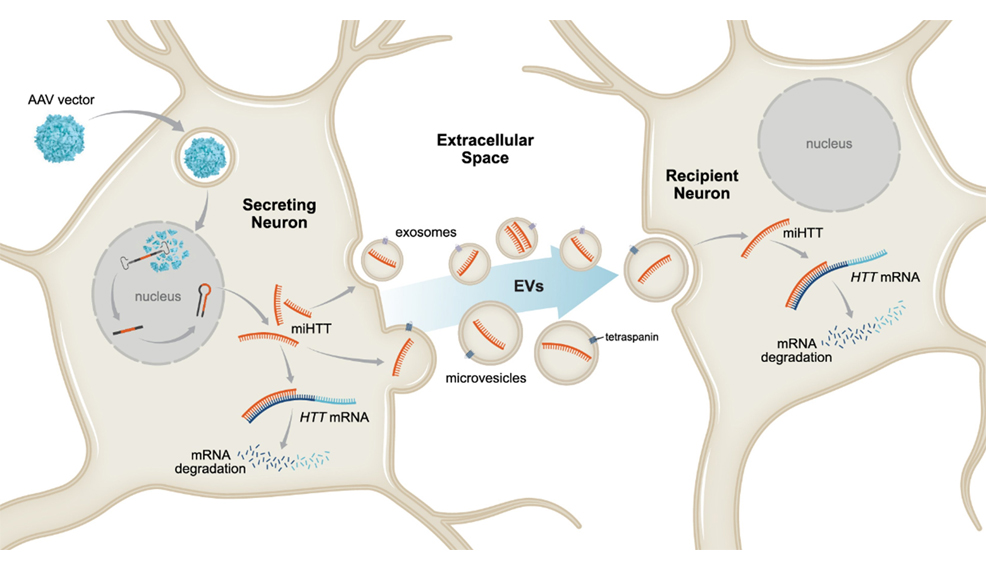 huntingtons disease brain neurons mrna