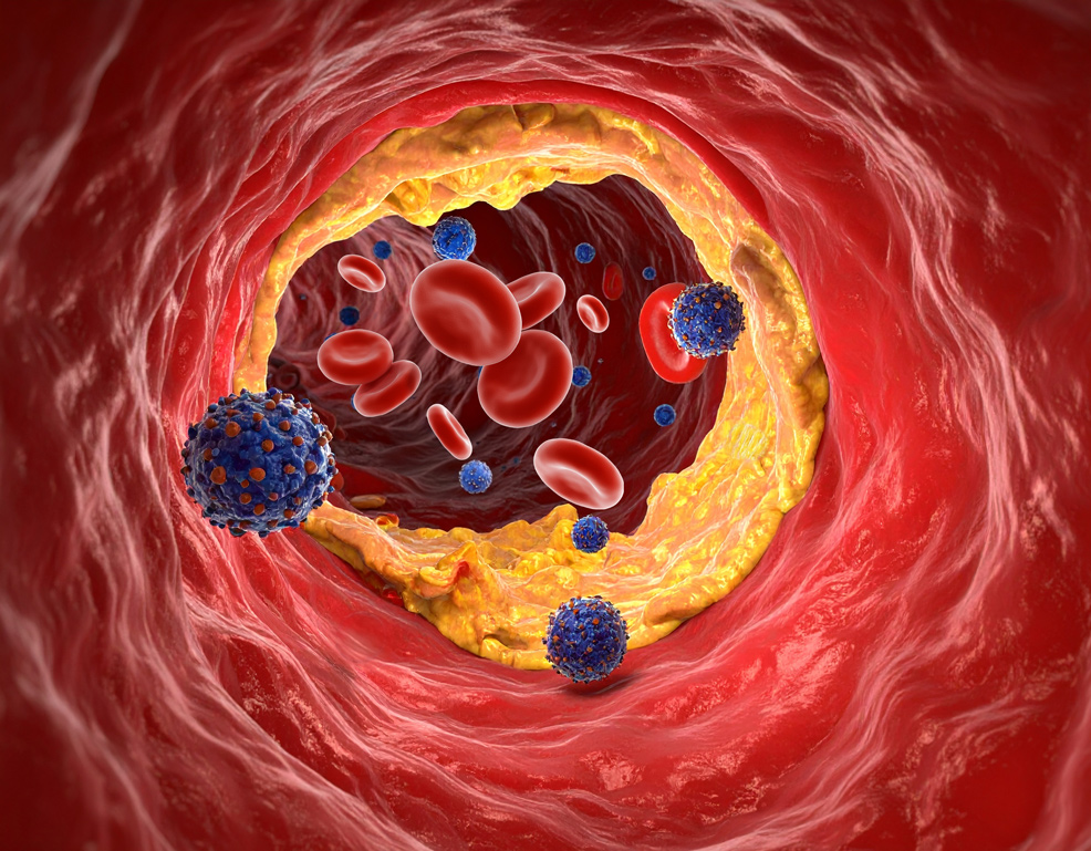 nanoparticles blood cells arterial plaque